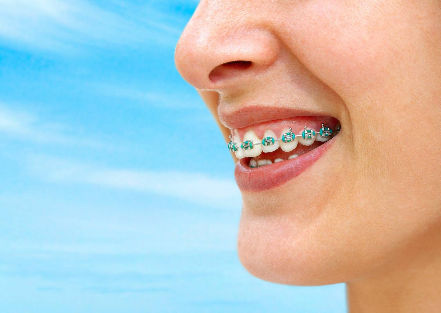 Sedation Dentist Kelowna