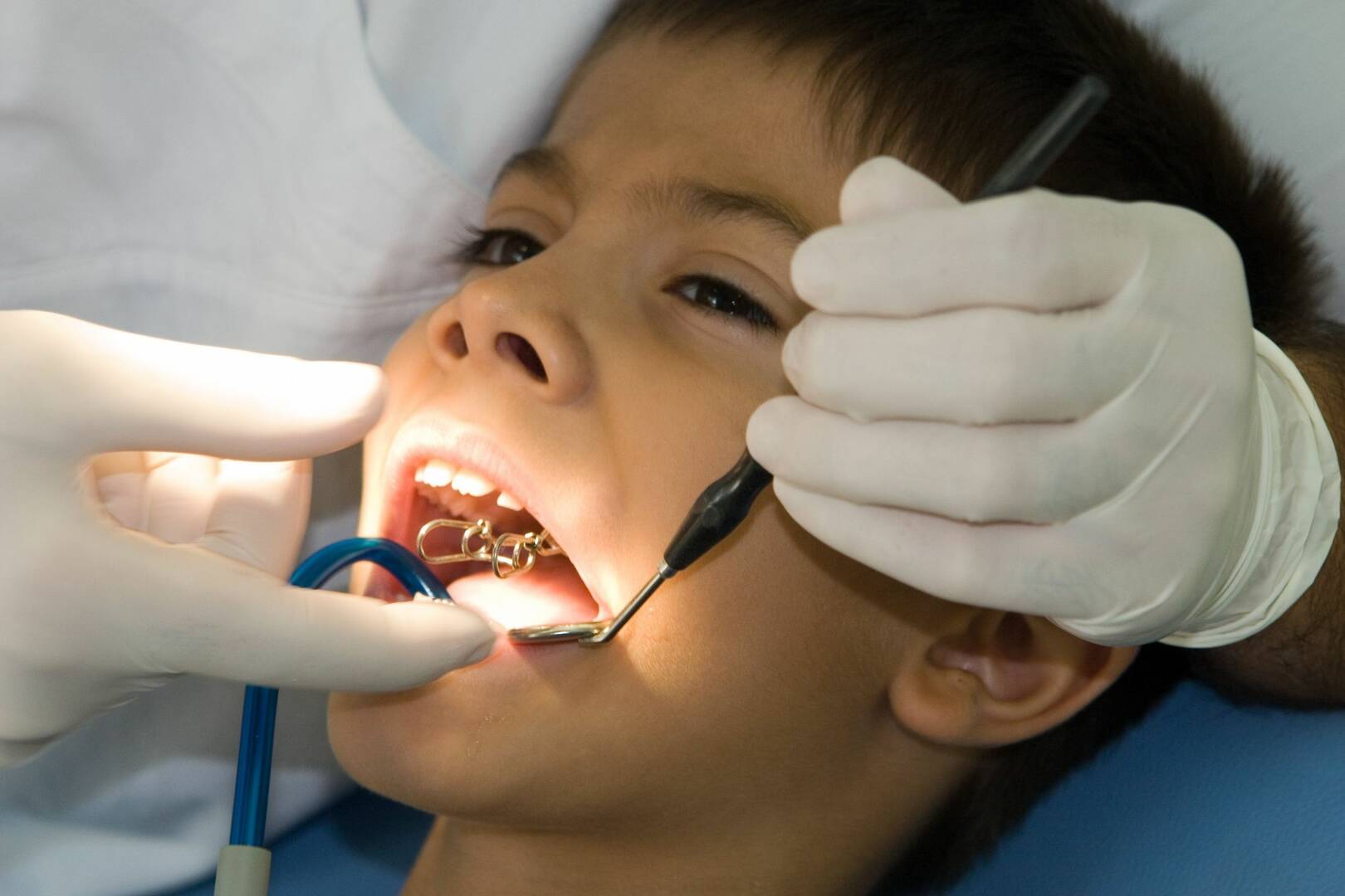 Pediatric Dentist In Coconut Creek FL